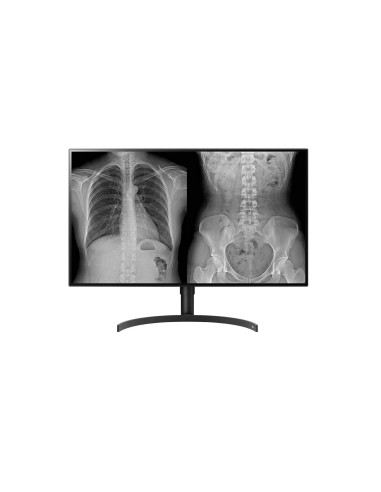 Monitor 32" LG 32HL512D-B.AEU 8MP Diagnostic Color, Negru