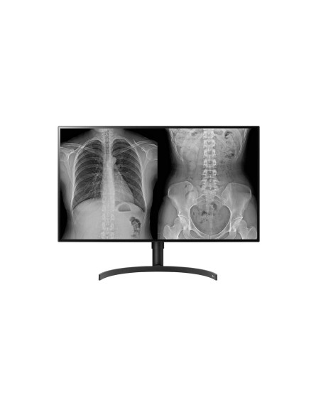 Monitor 32" LG 32HL512D-B.AEU 8MP Diagnostic Color, Negru